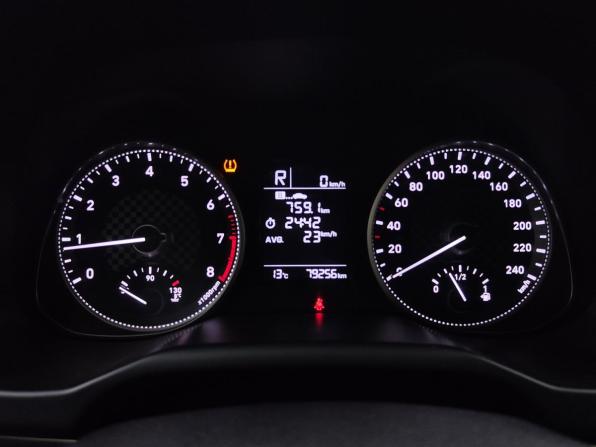 Hyundai Elantra VI (AD) Рестайлинг с пробегом 2019 года, цена 1 735 000 рублей, 79237 км, седан, Автокод Объявления