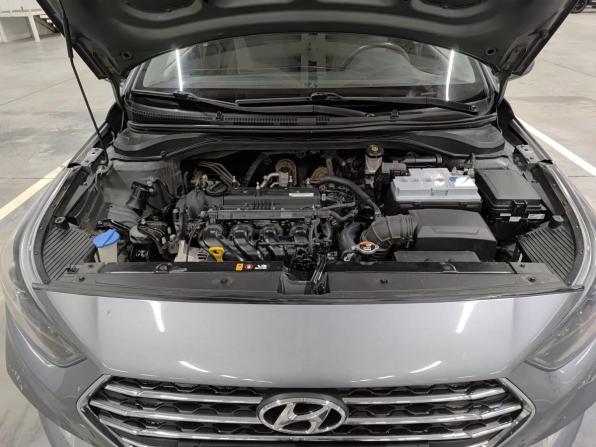 Hyundai Solaris II с пробегом 2017 года, цена 1 100 000 рублей, 165764 км, седан, Автокод Объявления