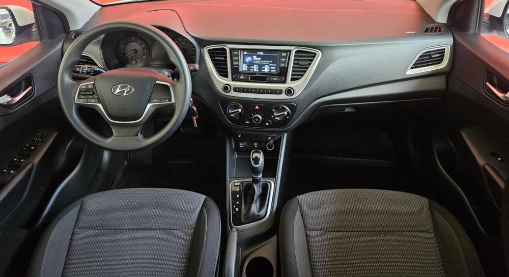 Hyundai Solaris II Рестайлинг Вологда  - изображение 9