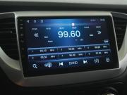 Hyundai Solaris II Рестайлинг Вологда  - изображение 29