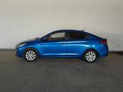 Hyundai Solaris II Москва  - изображение 24