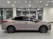 Hyundai Solaris II Казань  - изображение 27