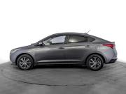 Hyundai Solaris II Рестайлинг Москва  - изображение 33