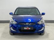 Hyundai Solaris I Тюмень  - изображение 31