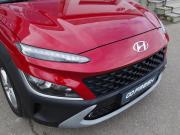 Hyundai Kona I Рестайлинг Владимир  - изображение 49