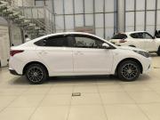 Hyundai Solaris II Рестайлинг Казань  - изображение 27