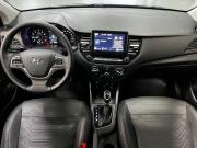 Hyundai Solaris II Рестайлинг Казань  - изображение 30