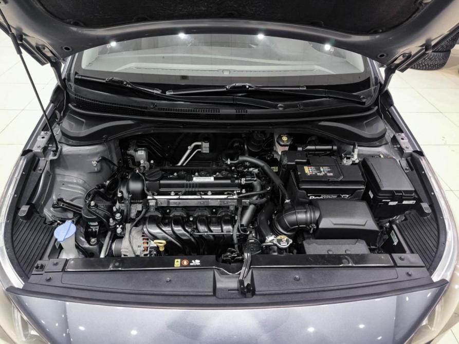 Hyundai Solaris II Рестайлинг Казань  - изображение 11