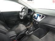 Hyundai Solaris II Рестайлинг Вологда  - изображение 27