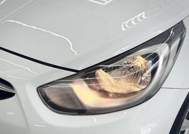 Hyundai Solaris I с пробегом 2011 года, цена 699 000 рублей, 283500 км, седан, Автокод Объявления