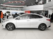 Hyundai Solaris II Рестайлинг Казань  - изображение 32