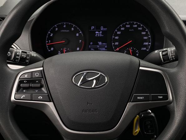 Hyundai Solaris II Рестайлинг с пробегом 2021 года, цена 1 649 000 рублей, 77597 км, седан, Автокод Объявления