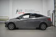 Hyundai Solaris I Рестайлинг Киров  - изображение 32