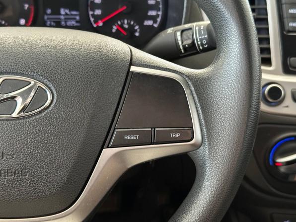 Hyundai Solaris II Рестайлинг с пробегом 2021 года, цена 1 367 000 рублей, 151225 км, седан, Автокод Объявления