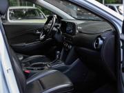Hyundai Kona I Санкт-Петербург  - изображение 30