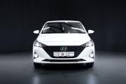 Hyundai Solaris II Рестайлинг Тюмень  - изображение 27