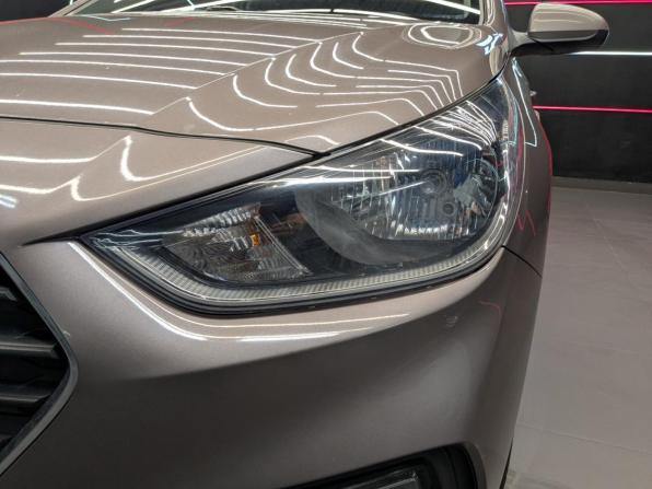 Hyundai Solaris II с пробегом 2018 года, цена 1 220 000 рублей, 155378 км, седан, Автокод Объявления