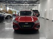 Hyundai Solaris II Тверь  - изображение 24