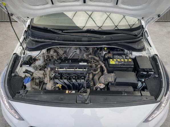 Hyundai Solaris II с пробегом 2017 года, цена 1 297 000 рублей, 144429 км, седан, Автокод Объявления