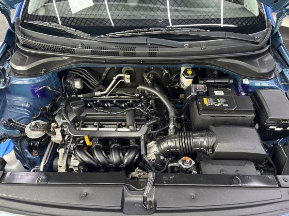 Hyundai Solaris II с пробегом 2017 года, цена 1 445 000 рублей, 74841 км, седан, Автокод Объявления