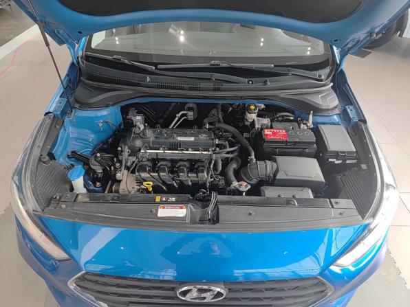 Hyundai Solaris II с пробегом 2019 года, цена 1 270 000 рублей, 150890 км, седан, Автокод Объявления