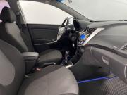 Hyundai Solaris I Воронеж  - изображение 31