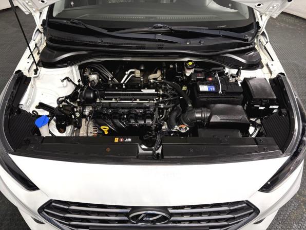 Hyundai Solaris II с пробегом 2017 года, цена 850 000 рублей, 142001 км, седан, Автокод Объявления