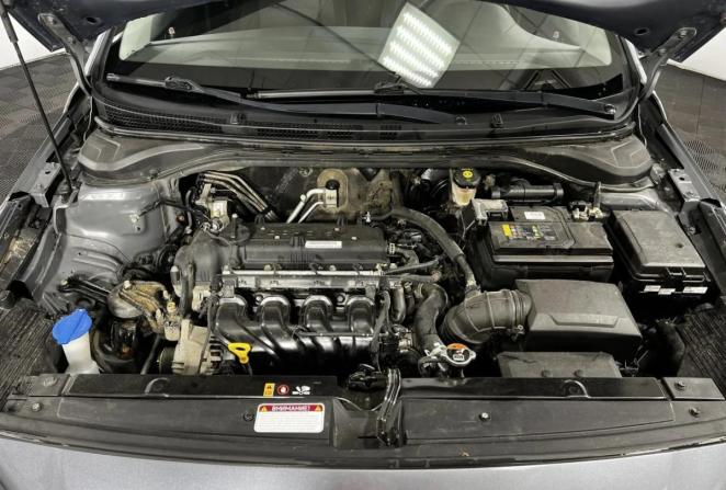 Hyundai Solaris II с пробегом 2018 года, цена 1 470 000 рублей, 94320 км, седан, Автокод Объявления