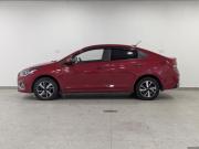 Hyundai Solaris II Москва  - изображение 52