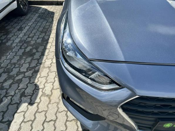 Hyundai Solaris II с пробегом 2018 года, цена 1 000 000 рублей, 150184 км, седан, Автокод Объявления