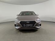 Hyundai Solaris II Уфа  - изображение 24