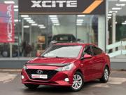 Hyundai Solaris II Рестайлинг Архангельск  - изображение 23
