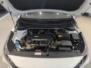 Hyundai Solaris II Рестайлинг Казань  - изображение 33