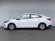 Hyundai Solaris II Рестайлинг Москва  - изображение 34