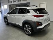 Hyundai Kona I Казань  - изображение 30