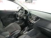Hyundai Solaris II Вологда  - изображение 26