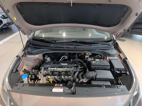 Hyundai Solaris II Рестайлинг с пробегом 2020 года, цена 1 468 000 рублей, 81900 км, седан, Автокод Объявления