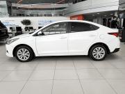 Hyundai Solaris II Рестайлинг Казань  - изображение 32