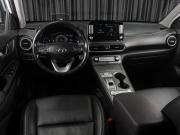 Hyundai Kona I Тюмень  - изображение 27