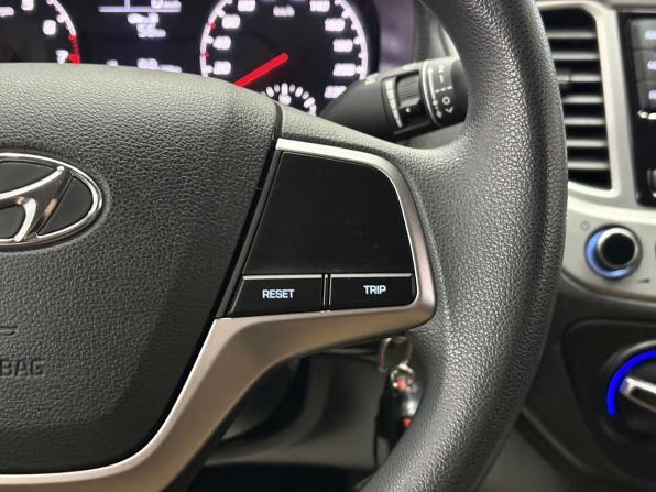 Hyundai Solaris II с пробегом 2020 года, цена 1 565 000 рублей, 70358 км, седан, Автокод Объявления