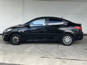 Hyundai Solaris I Петрозаводск  - изображение 21
