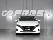Hyundai Solaris II Рестайлинг Минеральные Воды  - изображение 19
