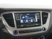 Hyundai Solaris II Рестайлинг Вологда  - изображение 30