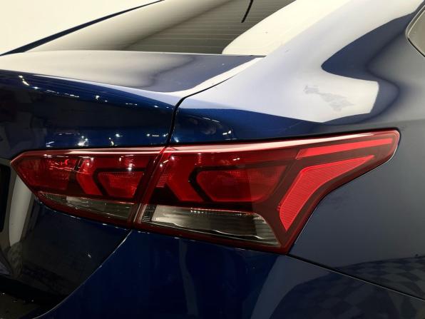 Hyundai Solaris II Рестайлинг с пробегом 2021 года, цена 1 499 000 рублей, 74816 км, седан, Автокод Объявления