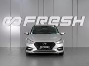 Hyundai Solaris II Минеральные Воды  - изображение 20