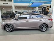 Hyundai Solaris II Рестайлинг Казань  - изображение 32