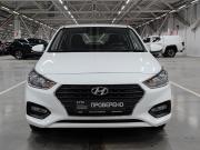 Hyundai Solaris II Казань  - изображение 26